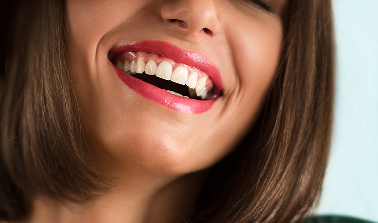 Implantes dentales para volver a lucir una bonita sonrisa - ¡Siéntete Guapa!